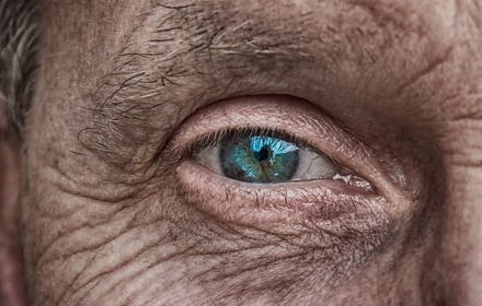 Eye2