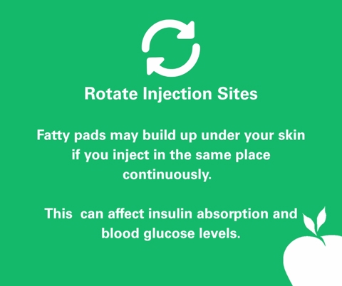 Rotate Injection Sites