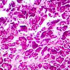 Research Sweden Cilia Cells And Diabetes Treatment Web