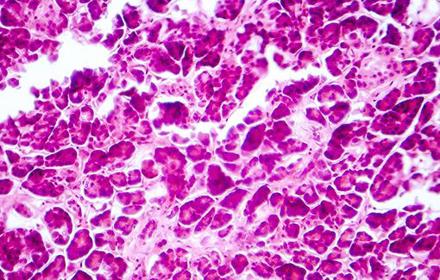 Research Sweden Cilia Cells And Diabetes Treatment Web