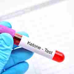 Blood Sample Tube For Ketone Test