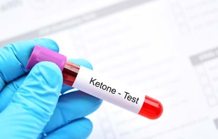 Blood Sample Tube For Ketone Test