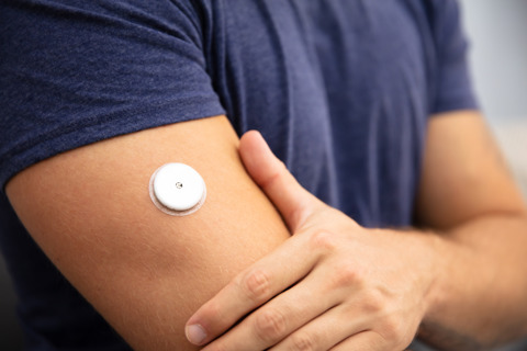 Man Testing Glucose Level With A Continuous Glucose Monitor