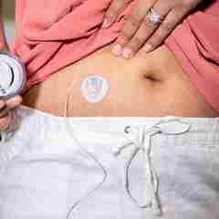 Woman Holds Insulin Pump In Her Hand