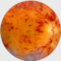 Non-diabetes-related issues