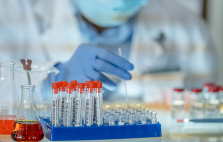 Medical Research Samples