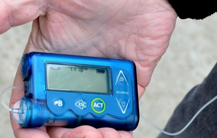 Insulinpump1