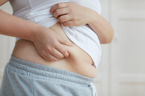 Obesity Image