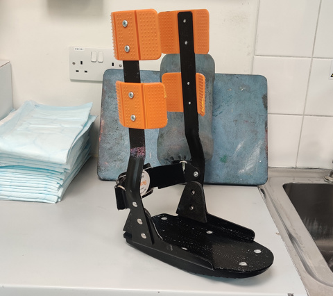 Charcot Foot Personal Story Andy Austin Pt2 Pic 6 (1)