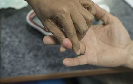 WHO Hands