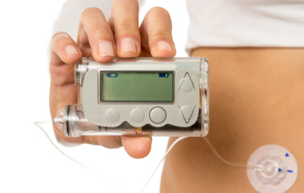 Person Holding Insulin Pump
