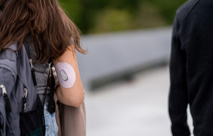 CGM Dexcom On An Arm