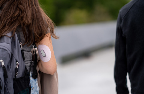 CGM Dexcom On An Arm