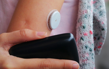 CGM On An Arm