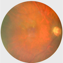 Unassessable results