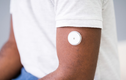 CGM On Arm